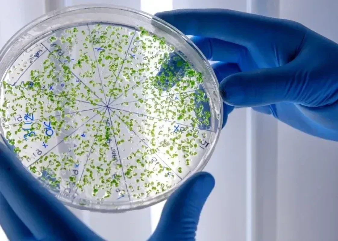 Kocaeli'de Peynir Alarmı: Listeria Tespit Edilen Ürünler Toplatıldı